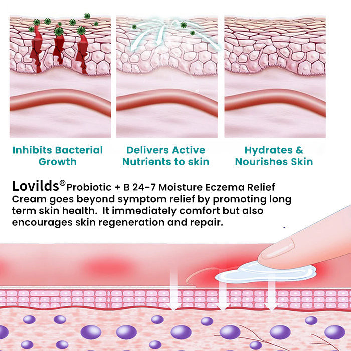 Lovilds® Probiotic + B 24-7 Moisture Eczema Relief Cream