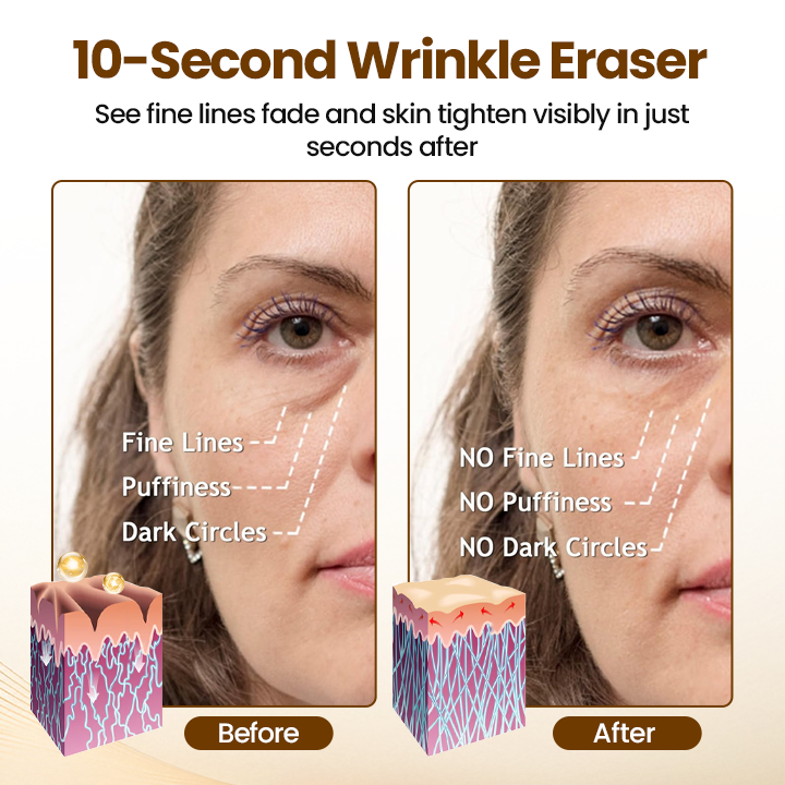 Renewing 10s Wrinkle Serum