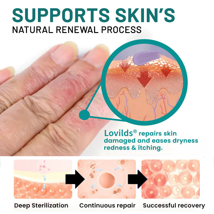 Lovilds® Probiotic + B 24-7 Moisture Eczema Relief Cream
